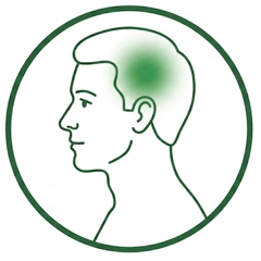 Illustration av huvudvärk / migrän